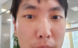 包含双效片副作用：视力模糊、蓝视症怎么办？的词条