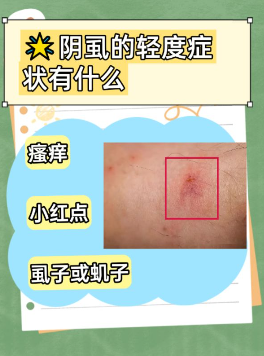 印度双效片真实效果与副作用：过敏、皮疹、腹泻案例的简单介绍-第2张图片-1